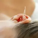 The Crazy Thing About Acupuncture Piercing